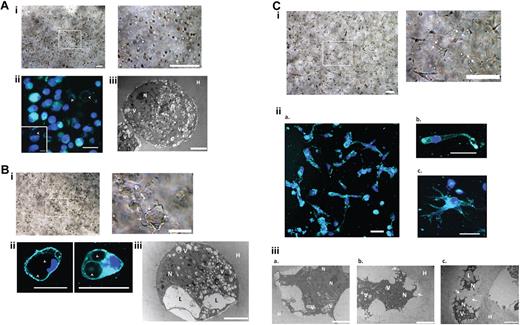Figure 3. ECFC encapsulation, morphogenesis, and network formation in HA gels (days 0-2). A. Vacuole formation observed a few hours after cell encapsulation using: (i) Light microscopy (LM) imaging (left panel) and higher magnification of vacuolated cells (indicated by arrowheads; right panel); (ii) vacuole vital stain FM 4-64 (cyan; nuclei in blue) of encapsulated cells and higher magnification of a vacuolated cell (indicated by arrowheads; inset). Scale bars are 100 μm. (iii) TEM high-resolution representative image of a single, rounded encapsulated cell. Scale bar is 10 μm. (B) Increased number and size of vacuoles and merging into large lumen detected by day 1 of culture, as indicated by: (i) LM imaging (left panel) and higher magnification showing merging lumen (indicated by the arrows; right panel); (ii) vacuole vital stain FM 4-64 (cyan; nuclei in blue) high magnification focused on cells containing large vacuoles (indicated by the arrowhead; scale bars are 50 μm); and (iii) TEM high-resolution representative image of an encapsulated cell with apparent vacuoles. N indicates nucleus; V, vacuoles; L, lumen; and H, hydrogels. Scale bar is 20 μm. (C) Progression in tubulogenesis through branching and sprouting and hydrogel degradation observed using: (i) LM imaging of encapsulated cells on day 2 (left panel) and higher magnification focusing on branching networks (arrows indicate an example; right panel; scale bars are 100 μm); (ii) vacuole vital stain FM 4-64 (cyan; nuclei in blue) on day 2 illustrating representative images of (a) network formation, (b) branching cell, and (c) sprouting cell (scale bars are 50 μm); and (iii) TEM high-resolution representative images of: (a) a cell with degraded surroundings; (b) elongated cell morphology; and (c) guiding channels of degraded hydrogel formed between adjacent cells (indicated by arrows). N indicates nucleus; V, vacuoles; L, lumen; and H, hydrogel. Scale bars are 20 μm.