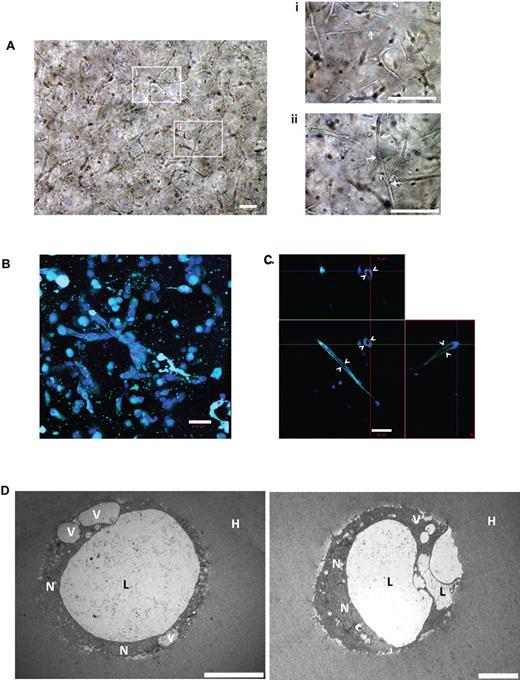 Figure 4. ECFC vascular network growth and complexity in HA hydrogels (day 3). (A) Left panel: Growth of comprehensive vascular networks are demonstrated using LM images at low magnification. Right panel: (i and ii) are high magnifications of white boxes (arrows indicate branched and elongated vascular networks). Scale bars are 100 μm. (B) Confocal analysis of vacuole vital stain FM 4-64 (cyan; nuclei in blue) demonstrating large lumen within the networks, and (C) demonstrated using orthogonal view (indicated by arrowhead). Scale bars are 50 μm. (D) TEM high-resolution images show cross-sections of matured vascular tube networks with enlarged lumens. Scale bars are 20 μm.