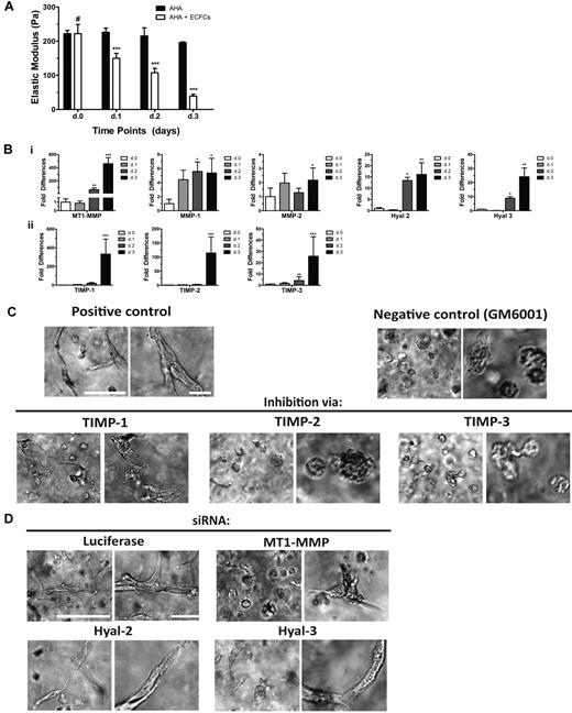 Figure 6. Cell and material interactions: matrix remodeling. (A) Viscoelasticity measurements revealed a decrease in hydrogel stiffness along the 3-day culture period, reaching 40 Pa in hydrogel encapsulated with ECFCs. (B) Real-time RT-PCR analysis shows increased expression of (i) MT1-MMP, MMP-1, MMP-2, Hyal 2, and Hyal 3 and (ii) TIMP-1, TIMP-2, TIMP-3, of encapsulated ECFCs along the 3-day culture period. Significance levels were set at: #P > .05, *P < .05, and **P < .01. (C) ECFCs undergo vascular morphogenesis in the absence (positive control) or presence of 5 μg/mL TIMP-1, TIMP-2, or TIMP-3. The presence of TIMP-1, TIMP-2, or TIMP-3 blocked tubulogenesis, as it did to the negative control (in the presence of 5μM GM6001). (D) siRNA suppression of MT1-MMP allowed vacuole formation and some extent of branching without luminal structures, while suppression of Hyal-2 or Hyal-3 did not affect vascular morphogenesis. Scale bars are 100 μm (left panel) and 10 μm (right panel).