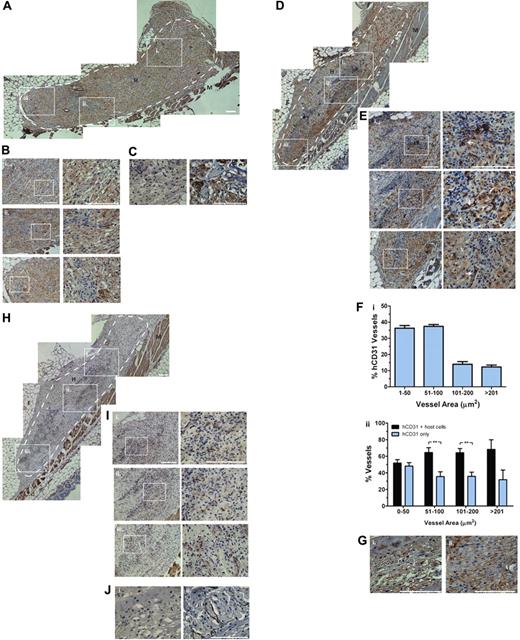 Figure 7. Functionality of vascular networks. (A) A montage of low magnification images of mouse F4/80-stained sections. (B) Subpanels i through iii are high magnifications of correlated boxes in panel A showing that macrophages degrade most implanted AHA hydrogels within 2 weeks of implantation, replacing them with macrophages (in brown) and tissue and vessel ingrowth (unstained cells). (C) Subpanel i, isotype control and subpanel ii, mouse F4/80-stained sections after 2 weeks of AHA only (without cells) implantation. (D) A montage of low-magnification images of human CD31-stained sections. (E) Subpanels i through iii are high magnifications of correlated boxes in panel D showing that ECFCs form microvessels with a human endothelial lining (some indicated by arrows), some of which contain blood cells and participate in the host angiogenesis, as indicated by the microvasculature containing both human ECFCs (some indicated by arrows) and unstained mouse host ECs (some indicated by arrowheads), which contain blood cells. (F) In subpanel i, quantification shows size distribution of microvessels with CD31+ cells; in subpanel ii, quantification shows 40% of the vessels were solely human microvasculature, while the rest are vessels with both human ECFCs and host ECs. (G) Subpanel i indicates isotype control, and subpanel ii, human-CD31 -stained sections after 2 weeks of AHA only (without cells) implantation. Some microvessels found within the hydrogels, which contained blood cells, are positive for α-SMA, as demonstrated by panel H. A montage of low-magnification images of α-SMA–stained sections. (I) Subpanels i through iii are high magnifications of correlated boxes in panels H and J. (i) Isotype control; (ii) α-SMA–stained sections after 2 weeks of AHA only (without cells) implantation, suggesting that the vessels could recruit host SMCs to stabilize the engineered vessels. Significance levels were set at: *P < .05 and **P < .01. Dashed white lines indicate the periphery of the gels. H indicates hydrogels; M, muscle; and F, fat tissue. Scale bars are 100 μm.