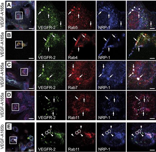 Figure 1. Localization of VEGFR-2 and NRP-1 in HUVECs. (A-D) HUVECs were stimulated with VEGF-A165a for 30 minutes and then stained for VEGFR-2, NRP-1, and the indicated Rab GTPase. VEGFR-2 and NRP-1 colocalized with Rab5, Rab4, Rab7, and Rab11 (arrows). (E) When the cells were stimulated with VEGF-A165b, no colocalization of VEGFR-2 with Rab11 was found whereas NRP-1 was still able to traffic through the Rab11 compartment (circles). Arrowheads indicate vesicles positive for NRP-1 and VEGFR-2. Scale bar: 20 μm (insets: 5 μm).
