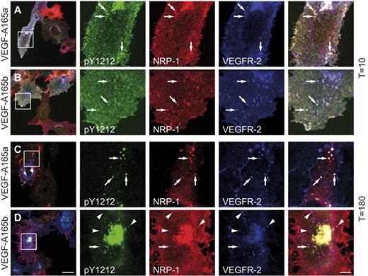 Figure 5. Tyrosine-phosphorylated VEGFR-2 always colocalizes with NRP-1 on stimulation with VEGF-A165a. PAECs stably expressing VEGFR-2 and NRP-1 were stimulated for 10 (A-B) or 180 (C-D) minutes with VEGF-A165a (A-C) or VEGF-A165b (B-D). Receptor phosphorylated at Y1212 accumulated at the plasma membrane 10 minutes after stimulation (A). In addition, vesicles with phosphorylated VEGFR-2 and NRP-1 are visible (A-B arrows). Phosphorylated VEGFR-2 disappeared from the plasma membrane 180 minutes after stimulation (C) and was now observed in NRP-1–positive vesicles (C arrows). Most VEGFR-2/NRP-1 positive vesicles showed a pY1212 signal after stimulation with VEGF-A165a (C). In contrast, many VEGFR-2/NRP-1 positive vesicles showed no pY1212 signal after stimulation with VEGF-A165b (D arrowheads). Similar data were observed for VEGFR-2 phosphorylation at Y1175 (supplemental Figure 4). Scale bar: 20 μm (insets: 5 μm).