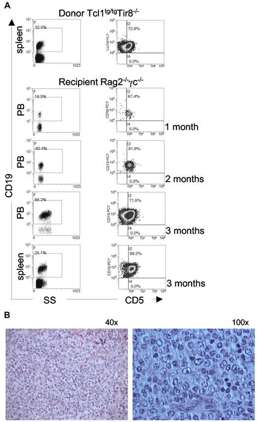 Figure 4. TCL1tg/tgTIR8−/− cells are leukemogenic. (A) CD19+ splenocytes (106 cells) were purified from 2 different TCL1tg/tgTIR8−/− mice and injected intraperitoneally into 8-week-old Rag2−/− γc−/− male mice (n = 9 each group). Mice were bled monthly, and analyzed for the appearance of CD19+CD5+ monoclonal population by flow cytometry; after 3 months mice were sacrificed, spleen removed and single cell suspension analyzed by flow cytometry for the expression for CD19 and CD5. One representative mouse shown. (B) Histopathologic examination of spleen of Rag2−/− γc−/− mice injected with TCL1tg/tgTIR8−/− (one representative animal sacrificed after 3 months of 9 analyzed): microscopic evaluation 40× and 100×.