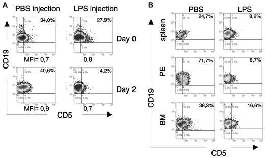 Figure 7. In vivo TLR-mediated downmodulation of CD5 expression on leukemic cells. (A) Leukemic TCL1tg/tgTIR8wt/wt mice were injected intraperitoneally either with 1μg/g LPS or PBS (n = 4 each group). 48 hours later, mice were bled and analyzed by flow cytometry. PB was analyzed before and after LPS injection for CD5 expression on leukemic cells. Plots from 1 mouse each group shown; 2 of 4 mice analyzed showed down-regulation of CD5 after LPS injection. MFI of CD19+CD5+ cells are indicated. (B) The same leukemic TCL1tg/tgTIR8wt/wt mice as in panel A were killed, organs removed and single-cell suspension analyzed by flow cytometry for the expression of CD19 and CD5. PE indicates peritoneal exudate; BM, bone marrow. Plots from 1 mouse in each group shown; 2 of 4 mice analyzed showed down-regulation of CD5 after LPS injection.