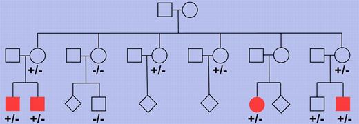 Pedigree of a Finnish family with multiple members affected by nodular lymphocyte predominant Hodgkin lymphoma. Multiple family members were tested for the presence of the truncating NPAT mutation and each of 4 cousins affected by the lymphoma showed this mutation (depicted as filled symbols). −/− indicates wild-type for the 2 base pair deletion in the NPAT gene and +/− indicates presence of the deletion on 1 allele. Where no genotype is indicated, no DNA was available for analysis. The pedigree has been modified for confidentiality.