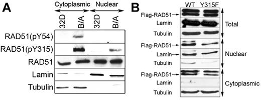 Figure 4. RAD51(pY315) is detected in the nuclei of BCR-ABL1-positive leukemia cells. (A) RAD51(pY54), RAD51(pY315), and total RAD51 were detected by Western blotting with the use of phospho-specific and with anti-RAD51 antibodies, respectively, in the cytoplasmic and nuclear lysates from 32Dcl3 parental cells (32D) and BCR-ABL1–positive counterparts (B/A). The amount of protein lysates run in the gel was adjusted to detect similar levels of RAD51. (B) Flag-RAD51(WT) and Flag-RAD51(Y315F) were expressed in B/A cells, and Flag-tagged RAD51 proteins were detected in total, nuclear, and cytoplasmic cell lysates by Western analysis using anti-Flag antibody (Flag-RAD51 bands are marked by arrow). Lamin and tubulin served as the lysates purity controls.