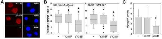 Figure 6. Peptide aptamer containing RAD51(pY315) inhibits HomeoRR in BCR-ABL1-positive leukemia cells. BCR-ABL1–32Dcl3-pLB4 leukemia cells and CD34+ CML-CP primary cells were incubated with 2μM of rhodamine-labeled Y315F or pY315 aptamer, or left untreated (−). (A) Cellular uptake of the aptamers in BCR-ABL1–32Dcl3-pLB4 leukemia cells was visualized by fluorescence after 4-hour incubation (left boxes). DNA was counterstained with 4,6-diamidino-2-phenylindole (right boxes). (B) RAD51 nuclear foci were detected using anti-RAD51 antibody in BCR-ABL1–32Dcl3-pLB4 cells and CD34+ CML-CP cells as indicated. Data are number of RAD51 foci/cell ± SD. *P < .001 versus untreated cells (Mann-Whitney test). (C) HomeoRR activity in I-SceI transfected GFP+ cells. Data are percentage of G418-resistant clones ± SD. *P < .03 versus untreated cells (Student t test).