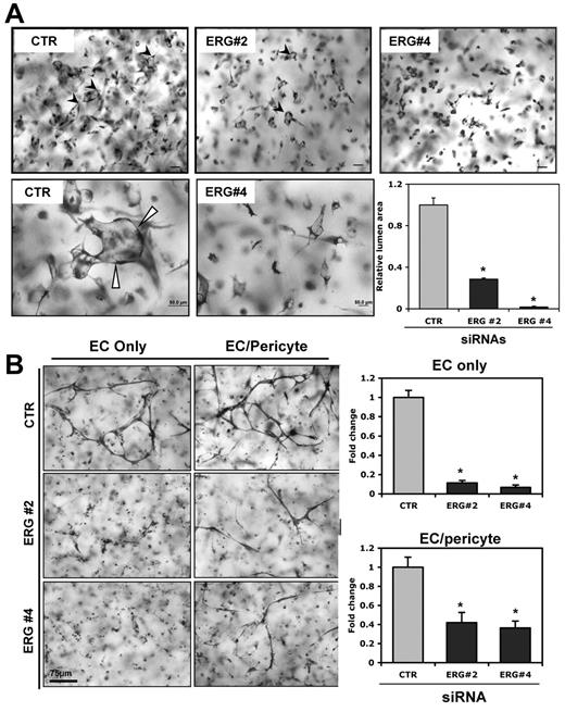 Figure 1. ERG knock-down blocks EC lumen and tube formation in 3D collagen matrices. ECs were treated with single siRNAs targeting ERG (siRNAs 2 and 4; 40 nmol/L) or control (40 nmol/L) and incubated for 24 hours. (A) Transfected HUVECs were seeded as single cells in 3D collagen type I matrices (at 2 × 106 cells/mL) to undergo lumen formation for 24 hours before preparation of fixation, staining, and photography. Representative fields of siRNA-treated ECs from lumen formation are shown as both lower- (top) and higher-powered (bottom) images. Arrows indicate EC lumens. EC luminal areas were quantitated using Metamorph software. Data shown are presented as normalized values of lumen area per high powered field relative to control (CTR) treatment ± SD, n = 20, P < .01. (B) Transfected HUVECs were seeded in 3D collagen matrices in the presence (EC/pericyte) or absence (EC only) of pericytes to undergo tube morphogenesis for 72 hours. Quantitation of relative vessel area was done on ERG suppression versus control conditions. Data shown are presented as normalized values of lumen area per high powered field relative to control treatment ± SD, n = 20, P < .01.