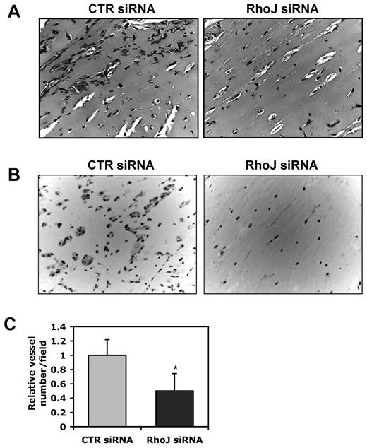 Figure 4. Effects of RhoJ on tube formation in Matrigel in vivo. Matrigel mixture containing 2μM control or RhoJ siRNA was injected subcutaneously into nude mice. The gel plugs were collected after 7 days. After fixation in paraffin, samples were embedded in paraffin, sectioned and H&E stained. (A) Representative images from H&E staining. (B) Representative images of immunohistochemistry staining using CD31 antibody. (C) The quantitative data are shown as the number of vessels containing red blood cells relative to the control condition (n = 5).