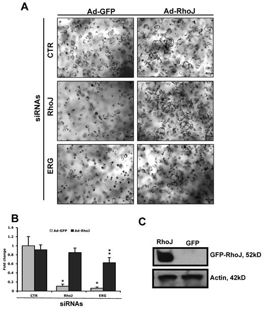 Figure 5. Partial rescue of ERG siRNA effects on EC lumen and tube formation by adenoviral delivery of RhoJ. (A-B) HUVECs were first transfected with ERG, RhoJ, or control siRNA (40 nmol/L) before infection with adenovirus encoding either GFP or RhoJ as indicated. ECs were then seeded in 3D collagen matrices for 24 hours. Lumen area was quantitated using Metamorph software and is presented relative to lumen area obtained for the control GFP adenovirus. *Comparison with CTR siRNA-treated EC. **Comparison with Ad-GFP infected EC with the same siRNA treatment. (C) ECs were infected with adenovirus encoding either GFP or RhoJ. The expression of GFP-RhoJ fusion protein was detected by Western blot using anti-RhoJ antibody and actin as a loading control.
