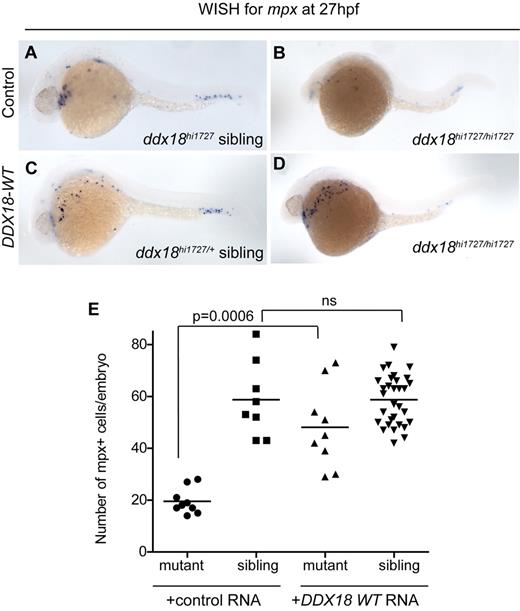 Figure 3. ddx18hi1727/hi1727 myeloid and developmental defects can be rescued with human DDX18. (A-D) Lateral view, head to the left embryos at 27 hpf. WISH for mpx in ddx18hi1727 siblings (A,C) and mutants (B,D), after injection of control (mCherry encoding; A-B) or human DDX18-encoding (C-D) RNA. Expression of the human DDX18 results in rescue of the ddx18hi1727/hi1727 mutant phenotype from both developmental and myeloid defects. (E) Scatter plot showing number of mpx-expressing cells per embryo. Line denotes the mean value. Statistical analysis performed using the Student t test with Welch correction. ns indicates not significant.
