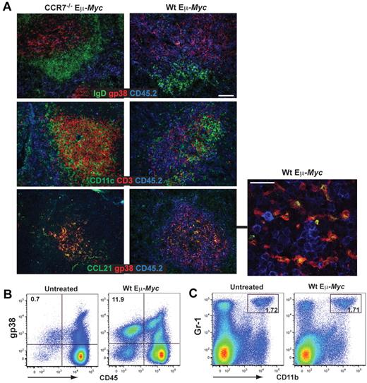 Figure 4. Induction of stromal networks supports Eμ-Myc lymphoma growth. (A) Congenic recipient mice were transplanted with Wt and CCR7−/− Eμ-Myc lymphoma cells, as described in Figure 2. Localization of malignant B cells in diseased spleens was visualized by immunofluorescence staining of frozen tissue sections. Wt and CCR7−/− Eμ-Myc lymphoma cells (blue, CD45.2+), gp38+ FRC network (red), B-cell zones (green, IgD+). Wt Eμ-Myc tumor cell (blue) expansion within and adjacent to the T-cell zone (middle panel: red represents CD3+ T cells; and green, dendritic cells, CD11c+). Colocalization (in yellow) of gp38+ FRC network (red) with the chemokine CCL21 (green) (lower panel). Scale bars represent 100 μm. At higher resolution obtained by confocal microscopy imaging, CCL21 staining largely overlaps with gp38 fluorescence (merged images, yellow; bottom panel, right, representative z-stack). Scale bar represents 25 μm. Data are representative of at least 3 independent experiments, with n = 4 or 5 mice per group. (B-C) Spleen from naive (n = 5) and Wt Eμ-Myc transplanted mice (days 10-13; n = 6) were collagenase-treated, followed by antibody staining and flow cytometric analysis. Percentages of gated gp38+/CD45− and CD11b+/Gr-1+ stroma cells are shown in the plots. *P ≤ .05 for gp38+/CD45−. P = not significant for CD11b+/Gr-1+.