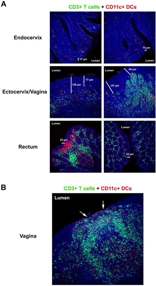 Figure 1. The mucosal barriers and HIV/SIV target cell composition. (A) Immunofluorescent micrographs (200×) of endocervix, ectocervix/vagina, and rectum stained for CD3+ T cells (green) and CD11c+ DCs (red) from a representative SIV-negative RM. The 2 different columns show the diversity and abundance of potential target cells in the same animal along the different mucosal barriers. The thickness of the respective epithelial barriers (in micrometers) is indicated in each image to highlight the heterogeneity that can exist in the thickness of the barrier that separates the host from its environment. (B) Immunofluorescent micrograph (200×) of vagina stained for CD3+ T cells (green) and CD11c+ DCs (red) from a SIV-negative RM with subclinical mucosal inflammation. The arrows point to regions of epithelial thinning where potential target cells are directly juxtaposed to the lumen. Note the densely packed T-cell infiltrate with numerous DCs beneath what remains of the epithelial barrier.