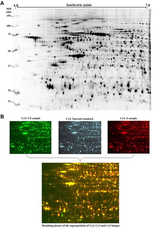 Figure 1. 2D-DIGE gel images. (A) Representative 2D image (scanned using an Ettan DIGE Imager, GE Healthcare) of a Cy2-labeled mixture of the 48 protein extracts (50 μg of each). The total number of polypeptide spots observed and matched is 928 (only polypeptide spots present in at least 75% of analytical images were retained). (B) False-colored representation of 2D images issued from a single gel: Cy3 and Cy5 images correspond to analytical samples and Cy2 to the internal standard. Superimposition of the 3 images colored by ImageMaster 2D Platinium Version 6.0 software (GE Healthcare) allows to represent overexpressed polypeptide spots in S samples in red and overexpressed polypeptide spots in US samples in green.