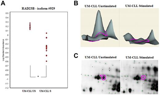 Figure 4. Example of 2D DIGE analysis of RAD23B protein expression. DIGE spots were analyzed with Decyder software Version 6.5 (GE Healthcare). (A) Statistical analysis of spot #929: significant decrease of RAD23B expression after BCR activation only in the UM-CLL subset. *P < .0001. (B) Decyder 3D representation of the RAD23B volume ratios difference between UM-CLL samples at baseline and after stimulation. (C) Focus of the RAD23B protein (spot #929) on US/S UM-CLL samples 2D gel images (scanned using an Ettan DIGE Imager, GE Healthcare).