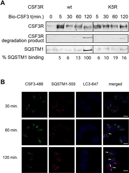 Figure 6. SQSTM1 binds to the CSF3R. (A) HeLa-CSF3R and HeLa-K5R cells were stimulated with Bio-CSF3 or left unstimulated (t = 0) for 10 minutes at room temperature, washed with RPMI and transferred to 37°C for indicated time points. CSF3R binding proteins were pulled down with streptavidin-coated beads from cell lysates and analyzed by Western blotting using monoclonal antibodies against CSF3R and SQSTM1. The percentage SQSTM1 binding relative to the amount of CSF3Rs is given. (B) HeLa-CSF3R cells were stimulated with CSF3-488 for 10 minutes at room temperature, washed and transferred to 37°C for indicated time-points. Subsequently, cells were fixed and stained for SQSTM1 (red) and LC3 (blue). Colocalization of CSF3R and SQSTM1 is indicated by the orange-yellow dots and yellow arrows. Colocalization of SQSTM1 with LC3 is indicated by the pink dots and arrows.