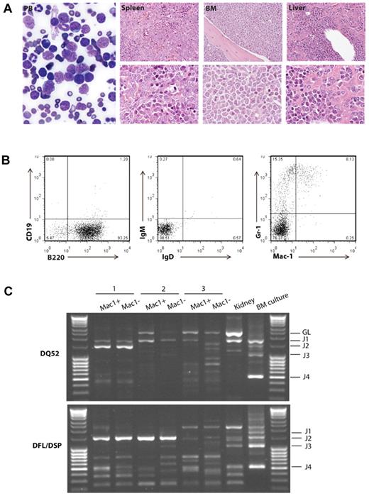 Figure 3. Etv6+/RUNX1 mice with “second hits” develop a pre-B ALL recapitulating features of the human disease. (A) Peripheral blood (PB; original magnification ×2000), spleen, bone marrow, and liver (original magnification ×400 in top panels and original magnification ×1000 in bottom panels) from a representative mouse with BCP-ALL. The presence of lymphoblasts in the PB is obvious, as is the infiltration of the spleen, bone marrow and liver, with effacement of the normal cellular architecture and replacement by nucleolated blasts. (B) FACS plots from the bone marrow of a representative mouse demonstrate only background Gr-1/Mac1 myeloid cells, with the majority of cells having a B220+/CD19−/sIg− phenotype in keeping with BCP-ALL. (C) D-J PCR rearrangement studies (involving DQ52 and DFL/DSP genes) were performed on spleen or bone marrow gDNA of 3 mice with phenotypic B-ALL. Negative control was gDNA from C57BL/6J mouse kidney (known to be unrearranged), and positive control was gDNA from a C57BL/6J primary pro-B cell bone marrow culture (known to contain a lot of DJ-rearranged alleles). Sample 1 shows 2 different rearrangement events (DQ52-J2 and DFL/DSP-J2), in keeping with a clonal B-cell population with both alleles D-J recombined. Sample 2 shows both a germ line band and an identical DFL/DSP-J2 band, in keeping with a clonal B-cell population with rearrangement of one allele and germ line configuration of the other. Sample 3 shows an absence of recombination.