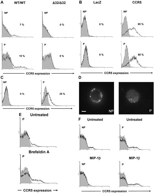 Figure 1. Immunofluorescence analyses of CCR5-stained fresh or permeabilized peripheral blood CD4+ T cells. (A) Specific detection of CCR5 molecules on and inside CD4+ T cells. CCR5 expression of nonpermeabilized (NP, top histograms) and permeabilized (P, bottom histograms) circulating CD4+ T cells from a WT/WT CCR5 (left histograms) and a Δ32/Δ32 (right histograms) donor were analyzed. For CCR5 extracellular detection, whole blood was stained with a phycoerythrin (PE)–conjugated anti-CD4 mAb and the anti-CCR5 mAb 2D7 conjugated to PE-cyanin-5 (PC5; open histogram) or with an isotype control (gray filled histogram). For CCR5 intracellular detection, peripheral blood mononuclear cells (PBMCs) were permeabilized using PBS containing 0.2% saponin as previously described.2 CCR5 expression was analyzed after gating for lymphocytes on the basis of forward and side scatter and then gating on CD4+ cells. The percentage of CD4+ T cells expressing CCR5 is indicated. (B) Detection of CCR5 molecules on and inside the Δ32/Δ32 CD4+ T cells transduced with CCR5. PBMC from a Δ32/Δ32 donor were transduced with an HIV-1–derived vector harboring the WT CCR5 gene (right histograms) or the LacZ gene (left histograms) as a negative control as previously described,7 permeabilized (P, bottom histograms) or not (NP, top histograms) 48 hours later, and processed as described in panel A. The percentage of CD4+ T cells expressing CCR5 is indicated. (C) Detection of intracellular CCR5 molecules by flow cytometry. PBMCs from a Δ32/Δ32 donor were transduced as described in panel B, incubated 48 hours later with 1 μg/mL 2D7, permeabilized (P, right histogram) or not (NP, left histogram), and processed as described in panel A. The percentage of CD4+ T cells expressing CCR5 is indicated. (D) Detection of intracellular CCR5 molecules by immunofluorescence microscopy. Wide-field immunofluorescence image of nonpermeabilized (NP) and permeabilized (P) PBMCs from a WT/WT CCR5 donor labeled using the 2D7 primary antibody (1 μg/mL) and a FITC-conjugated goat anti–mouse antibody. Cells were observed with a Leica DM6000 microscope. Scale bar, 3 μm. (E) Effect of brefeldin A on CCR5 staining of permeabilized (P) CD4+ T cells. PBMC from a WT/WT CCR5 donor were incubated (bottom histogram) or not (top histogram) for 24 hours with 10 μg/mL brefeldin A (BFA). Cells were then incubated with 1 μg/mL 2D7, permeabilized, and then processed as described in panel C. One representative experiment of 3 performed is shown. (F) Ligand-induced internalization of CCR5. PBMCs from a WT/WT CCR5 donor were incubated (bottom histograms) or not (top histograms) for 1 hour at 37°C with 500 ng/mL MIP-1β, and permeabilized (P, right histogram) or not (NP, left histogram). Nonpermeabilized cells were processed as described in panel A, and permeabilized cells as described in panel C. One representative experiment of 3 performed is shown.