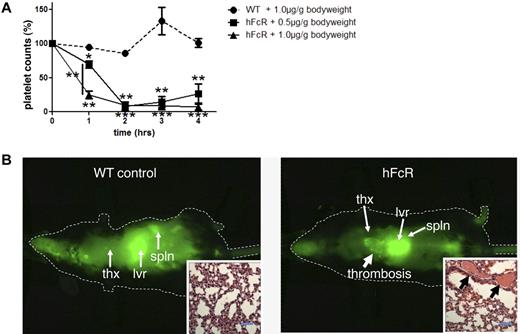 Figure 5. Antiplatelet antibody-induced thrombocytopenia and thrombosis in vivo. (A) Platelet count of hFcR transgenic mice (solid line) injected with 0.5 μg/g (■) or 1.0 μg/g (▴) body weight of anti-GPIX antibody. Platelet count of WT mice injected with anti-GPIX (1 μg/g body weight) is shown as control (dashed line, ●). The platelet counts in whole blood were determined at baseline (t = 0) and every hour up to 4 hours. Results shown are percentage platelet count compared with baseline. *P < .05. **P < .01. ***P < .001. (B) Whole-body scan with a Pearl in vivo Imager of hFcR mice and WT mice 4 hours after the injection of Alexa750-labeled anti-GPIX antibody (1 μg/g body weight) LICOR, Pearl infrared chamber, software Pearl cam Version 2.0. thx indicates thorax; lvr, liver; and spln, spleen. (Insets) Representative H&E-stained histology sections of lungs isolated from WT or hFcR mice. Arrows point at fibrin and platelet-rich thrombi in the lung vasculature. Images are representative of 3 independent experiments. Scale bar represents 50 μm. The images were obtained with a Nikon Eclipse 80i microscope (Nikon) and a 40×/0.8 numeric aperture oil-immersion objective lens, imaging medium: oil, H&E staining, Spot Flex Color camera (Diagnostic Instruments), Spot Advanced Version 4.5 software (Diagnostic Instruments).