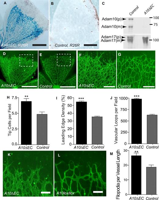 Figure 1. Adam10 deficiency in endothelial cells causes increased vascular density at the front of the developing retinal vasculature. (A,B) Lac-Z staining of retinas from A10ΔEC-R26R or A10flox/flox-R26R control mice. (C) Immunoblot of Adam10 and Adam17 in primary endothelial cells isolated from lungs of A10flox/flox control or A10ΔEC mice (p: pro-form, m: mature form). (D-G) Isolectin-B4 staining of retinas from 5-day-old A10ΔEC or control mice. Panels F and G correspond to the area marked by insets in panels D and E, respectively. (H-J) Quantitative analysis of tip cell density (H, A10ΔEC: 6.9 ± 1.8 per 100 μm of vascular front, n = 15; controls: 4.9 ± 1.4, n = 15), endothelial cell coverage at the front of the retinal vascular tree (I, A10ΔEC: 54.8% ± 4.42, n = 17; controls: 35.3% ± 3.8, n = 21), and vascular loops per field (J, A10ΔEC: 980 loops per mm2 ± 65, n = 17, controls 628 ± 68 per mm2, n = 21). (K,L) Micrographs of tip cells at the leading edge of the developing retinal vascular tree in A10ΔEC and control mice, and quantitative analysis of filopodia density (M, A10ΔEC: 26.4 ± 6.8 per 100 μm vessel length, n = 15, controls: 18.6 ± 5.6, n = 15). Please see “Evaluation of developmental retinal angiogenesis” and supplemental Figure 1 for details. Error bars represent mean ± SEM. ** indicates P < .01, and *** indicates P < .001 in a 2-tailed Student t test. Scale bars in panels A-B: 300 μm; D-E: 400 μm; F-G: 100 μm, K-L: 20 μm.
