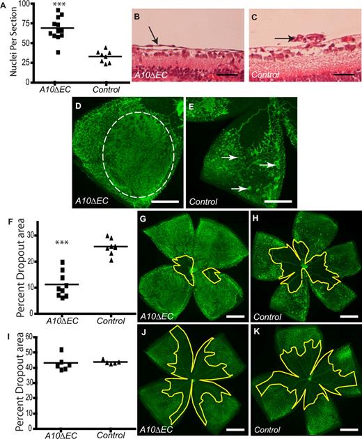 Figure 2. Oxygen Induced Retinopathy (OIR) in A10ΔEC mice. (A) Quantitative analysis of cell nuclei found vitreal to the internal limiting membrane after OIR in A10ΔEC and control mice (A10ΔEC: 68.9 ± 4.2, n = 12; controls: 33.3 ± 2.6, n = 8). (B,C) Histologic analysis revealed an abnormal sheet-like vascular structure (marked by an arrow) in an A10ΔEC retina (B) and a typical neovascular tuft (pointed by an arrow) in a control retina (C). (D-E) Micrographs of a segment of an Isolectin B4-stained retina from an A10ΔEC mouse showed a sheet-like vascular structure (outlined by a dotted line in panel D), whereas typical neovascular tufts were visible in a retina from a control mouse (marked by arrows in panel E). (F) Quantification of the size of the central avascular area in A10ΔEC eyes compared with controls after a 5-day period at room air (p17; A10ΔEC: 11.3 ± 1.5%, n = 9; controls: 25.7% ± 1.1% n = 8), and corresponding representative micrographs of A10ΔEC (G) or control (H) retinas. (I) Quantification of the avascular area in A10ΔEC (J) and control (K) retinas after 5 days at 75% oxygen (p12; A10ΔEC: 43.2 ± 2.0%, n = 6; controls: 43.8% ± 0.6%, n = 5). The central avascular area is bounded by a yellow line in panels G,H,J and K. ***P < .001 in a 2-tailed Student t test. Scale bars in panels B-C: 50 μm; D-E: 400 μm; G-H,J-K: 750 μm.