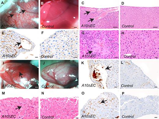 Figure 4. Histopathologic analysis of the liver, heart and diaphragm in adult mice. (A-D) Livers from A10ΔEC animals had enlarged vessels under the surface in gross (A) and histologic (C) specimens that were not present in livers from control animals (B,D). (E-F) MECA-32 immunohistochemistry of liver sections from A10ΔEC (E) and control (F) individuals showed positive staining for endothelial cells lining vascular structures. Arrows mark the abnormally enlarged vessels in panels A,C and E. (G,H) Liver sections from A10ΔEC mice demonstrated areas of coagulative necrosis (G, arrow) not present in controls (H). (I,J) A heart from an A10ΔEC animal showed numerous, dilated, superficial blood-filled vascular structures (marked by an arrow in panel I) that were not present in a heart from a control animal (J). (K,L) MECA-32 immunohistochemistry of a heart section from an A10ΔEC mouse (K) showed positive staining for endothelial cells surrounding the enlarged vascular structures (pointed by an arrow in panel K) that were not present in a control heart (I). (M-N) Histopathologic analyses of muscular diaphragm specimens revealed increased cellularity between myofibers in A10ΔEC animals (M, arrow) compared with controls (N). (O-P) MECA-32 immunohistochemistry of diaphragm sections from A10ΔEC (O) and control (P) individuals showed positive staining of cells present between myofibers of A10ΔEC diaphragms (arrow in panel O). The micrographs of vascular abnormalities on H&E-stained sections are representative of all animals analyzed for each genotype (n = 6). Scale bars in panels A-B: 1000 μm; C-D: 100 μm; E-H,K-P: 20 μm; I-J: 500 μm.