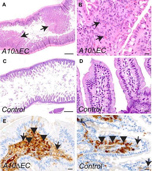 Figure 5. A10ΔEC mice develop intestinal polyps. (A-D) H&E staining of intestine from an A10ΔEC (A-B) and control (C-D) mouse revealed hyperplastic intestinal polyps (indicated by arrows in panel A) with marked hypercellularity within the lamina propria of A10ΔEC individuals (marked by arrows in panel B). (E-F) Almost all cells within the lamina propria of the enlarged polyps in A10ΔEC intestine stained positively for MECA-32 (E, arrow), while less than half the cells were MECA-32–positive in the corresponding area in control villi (F). Please note that the round dark-staining cells marked by arrowheads most likely represented plasma cells and not endothelial cells. Scale bars in panels A,C: 500 μm; B,D-F: 20 μm.