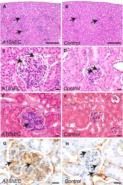 Figure 6. A10ΔEC mice display marked glomerular pathology. (A-D) H&E staining of kidney sections revealed enlarged glomeruli (A) with increased cellularity (C) in A10ΔEC mice (A,C) compared with control mice (B,D; arrows point to glomeruli in panels A and B, and to glomerular microvessels in panels C and D). (E-F) Masson trichrome staining revealed increased amounts of blue-staining material consistent with increased collagen deposition within glomeruli of A10ΔEC individuals (indicated by arrow in panel E) not present in control individuals (F). MECA-32 immunohistochemistry of kidney sections showed positive staining of most cells present within glomeruli of an A10ΔEC mouse (H, arrows), with only few capillaries stained in a glomerulus of a control mouse (G, arrows). Scale bars in panels A-B: 200 μm; C-H: 20 μm.