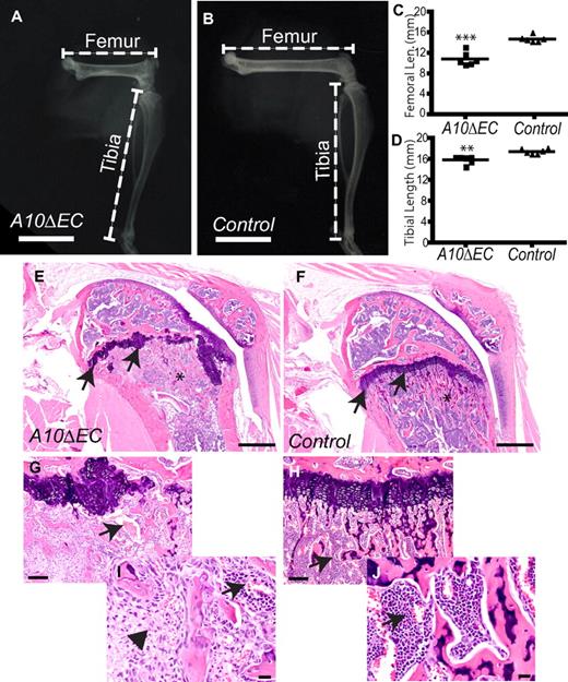 Figure 7. Long bone growth is impeded in A10ΔEC mice. (A,B) Radiographs of the hind limb of an A10ΔEC mouse (A) revealed a substantially shorter femur than in a control mouse (B). (C-D) Quantification showed significant reduction in the length of the femur and tibia in A10ΔEC mice compared with controls (C; femur length, A10ΔEC:10.9 mm ± 0.5 n = 6; controls: 14.7 mm ± 0.3 n = 6; D; tibia length, A10ΔEC: 15.9 mm ± 0.3 n = 6; controls: 17.4 mm ± 0.2 n = 6,). (E-J) H&E staining of femoral condyles from A10ΔEC (E,G,I) or control mice (F,H,J) revealed an abnormal growth plate (arrows in panel E), disturbed trabecular bone architecture (asterisk in E), abnormally oriented and enlarged vessels (arrow in panel G) and aberrant spindle shaped stromal cells (arrowhead in panel I) in A10ΔEC specimens compared with the normal growth plate (arrows in panel F), trabecular bone (asterisk in panel F), vessels (arrow in panel H) and compact hematopoietic cells within the marrow compartment (arrows in I,J) in controls. Data show mean ± SEM. Scale bars in panels A-B: 8 mm; E-F: 500 μm; G-H: 100 μm; I-J: 20 μm.