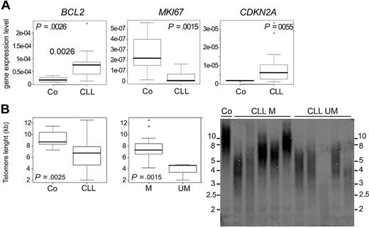 Figure 2. CLL classic molecular and telomeric features. (A) BCL2, MKI67, and CDKN2A (respectively coding for Bcl2, Ki67, and p16) normalized gene expression level, quantified in purified B cells from 6 healthy donors and 20 stage A CLL patients. Wilcoxon test P values are indicated in each corresponding box plot. (B) Telomeric size was analyzed by Teloblotting on B lymphocytes purified from 12 healthy donors and 20 CLL patients. Box plot showing telomere size, with corresponding Wilcoxon test calculated P values in healthy (Co) versus CLL (CLL) B cells (left) and in mutated (M) versus unmutated (UM) CLL B cells (right). A representative picture of telomeric restriction fragment analysis of one normal B cells (Co), 5 CLL mutated patients (CL M), and 5 CLL unmutated patients (CLL UM) is shown (right). Telomere size (in kb) was calculated thanks to specific ladder, size is indicated on each side of the Teloblot.