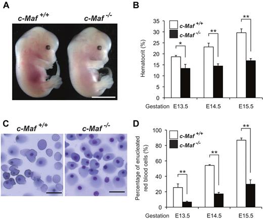 Figure 1. c-Maf−/− embryos are anemic. (A) Gross appearance of E13.5 embryos. The c-Maf−/− embryo is paler and smaller than its c-Maf+/+ littermate. Scale bar represents 5 mm. The picture was taken with a NIKON coolpix 5200 digital camera in macro mode and processed with the Adobe Photoshop CS4 software. (B) Hematocrit values for c-Maf+/+ (n = 6) and c-Maf−/− (n = 6) embryos at E13.5, c-Maf+/+ (n = 8) and c-Maf−/− (n = 7) embryos at E14.5, and c-Maf+/+ (n = 12) and c-Maf−/− (n = 9) embryos at E15.5. Data are presented as mean ± SEM. The mean hematocrit values for c-Maf−/− embryos were significantly lower than values for c-Maf+/+ at E13.5, E14.5, and E15.5. (C) Blood smears from E13.5 embryos stained with May-Grünwald-Giemsa stain. The blood smear from a c-Maf−/− embryo contains far fewer enucleated red blood cells. Images were acquired by a Biorevo BZ microscope (Plan Apo 20×0.75 DIC N2) at room temperature and processed with the Adobe Photoshop CS4 software. Scale bars represent 20 μm. (D) The percentage of enucleated red blood cells in peripheral blood for c-Maf+/+ (n = 5) and c-Maf−/− (n = 7) embryos at E13.5, c-Maf+/+ (n = 4) and c-Maf−/− (n = 4) embryos at E14.5, and c-Maf+/+ (n = 8) and c-Maf−/− (n = 8) embryos at E15.5. A minimum of 200 cells was counted for each sample. Data are presented as mean ± SEM. The percentage of enucleated red blood cells is significantly reduced in c-Maf−/− embryos than in c-Maf+/+ embryos at E13.5, E14.5, and E15.5. *P < .05 and **P < .01.