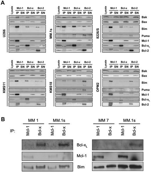 Figure 3. Binding of Bim to Bcl-xL and Bcl-2 in myeloma cell correlates with codependence and sensitivity to ABT-737. (A) Coimmunoprecipitation of proapoptotic proteins with Mcl-1, Bcl-xL, and Bcl-2 was determined by Western blot analysis after lysing all 6 cell lines in 2% 3(3-cholamidopropyl) dimethylammonio-1-propane sulfonate buffer and immunoprecipitating with specific monoclonal antibodies as described in “Antibodies.” and “Coimmunoprecipitation studies.” Lysates and supernatant contain 7%, whereas the immunoprecipitated proteins contain 60% of the input. (B) CD138+ myeloma cells were isolated, and 1 million cells were subjected to lysis and immunoprecipitation with anti–Bcl-x and anti–Mcl-1 antibodies as described in “Antibodies” and “Coimmunoprecipitation studies.” Immunoprecipitates were subjected to SDS-PAGE and Western blot analysis performed for Bcl-xL, Mcl-1, and Bim. Two of 6 patient samples tested are shown, and each experiment was performed in parallel with MM.1s as a reference.
