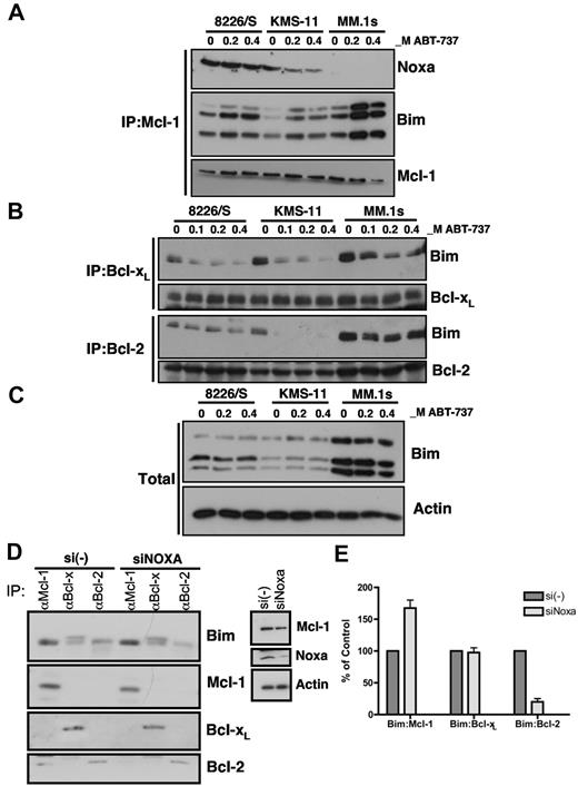 Figure 5. Noxa expression inhibits Mcl-1 binding to Bim displaced from Bcl-xL and Bcl-2. 8226/S, MM.1s, and KMS11 cell lines were treated with indicated concentrations of ABT-737 for 24 hours and lysates generated as described in “Western blot analysis.” (A) Mcl-1 and (B) Bcl-xL and Bcl-2 were immunoprecipitated using specific monoclonal antibodies. Immunoprecipitates were sequentially probed with pAbs for Bim and Noxa as well as for Bcl-2, Bcl-xL, and Mcl-1. Immunoprecipitates contain 60% of input. (C) The total amount of Bim was assayed by Western blot in lysates from control and treated samples of 8226/S, KMS-11, MM.1S. (D) Twenty-four hours after transfection with si(-) or siNoxa, expression of Noxa and Mcl-1 was determined by Western blot (right panel). The remaining lysate was subjected to immunoprecipitation with Mcl-1, Bcl-xL, or Bcl-2 followed by Western blot analysis of Bim, Mcl-1, Bcl-xL, and Bcl-2 (left panel). (E) The bands from 2 independent experiments were quantified using ImageJ software Version 1.45r, and the graph represents the average ratio of relative intensity of indicated bands.