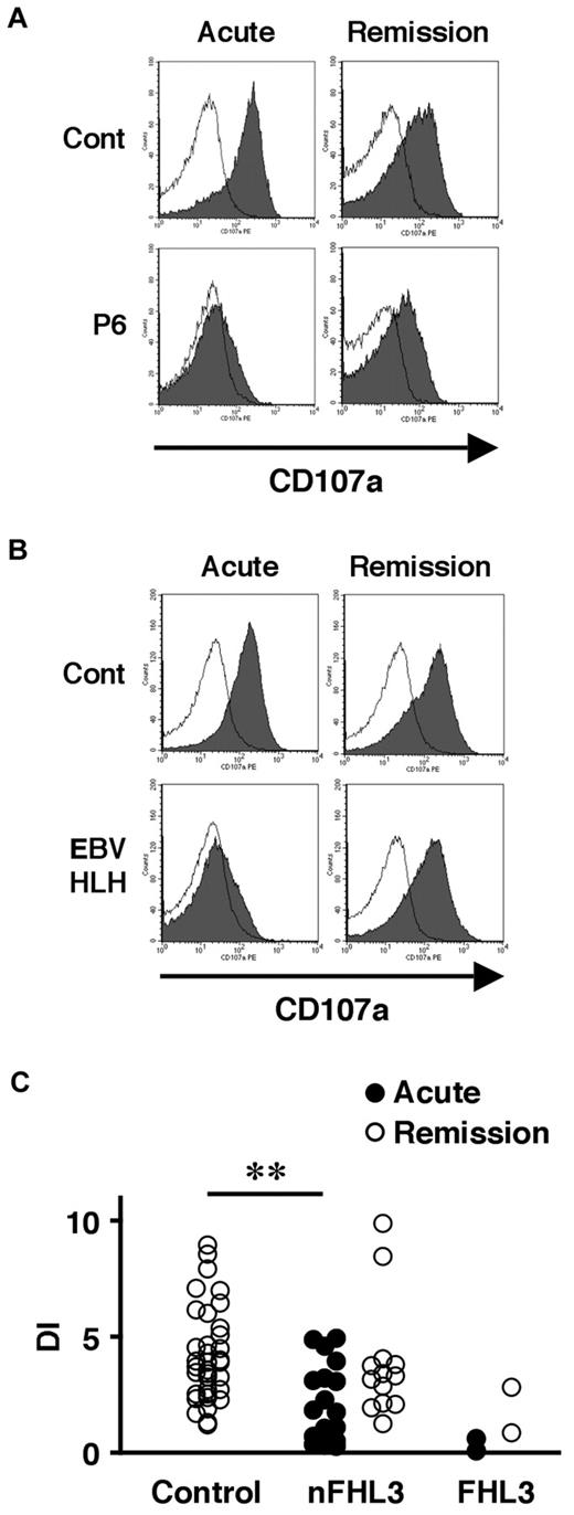 Figure 3. Analysis of lysosomal exocytosis using platelets from HLH patients. Platelets from an FHL3 patient (P6; A) and from a secondary (EBV-associated) HLH patient (B) along with healthy controls were left untreated (open histogram) or were stimulated with thrombin (closed histograms), and the surface expression of CD107a was analyzed by flow cytometry. Analysis was performed during the acute phase of the disease (left column) and after clinical remission (right column). (C) Degranulation index (DI) of platelets from HLH patients during the acute phase (●) and after clinical remission (○). HLH patients with normal NK-cell degranulation and Munc13-4 protein expression by Western blot analysis were defined as non-FHL3 (nFHL3). **P < .01 by the Tukey post hoc test.