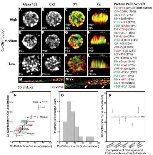 Figure 1. Quantitative codistribution data indicate a stochastic pattern to the intermixing of α-granule proteins in resting human platelets. Resting human platelets were isolated and the distribution of 13 different platelet α-granule content proteins determined by pair-wise immunolabeling followed by Z-series spinning disk confocal microscopy. (A-L) Qualitative distribution of representative high, medium, and low codistribution pairings: (A-D) thrombospondin and platelet factor 4; (E-H) fibrinogen and thrombospondin; (I-L) fibrinogen and plasminogen. (A-L) Images are maximum intensity projections of confocal image stacks. Note that the XZ images are stretched in the Z dimension because of the approximately 3-fold lower resolution of confocal microscopy in the Z than XY dimension. (M,M′) 3D-SIM of human platelets stained for fibrinogen (Fibr, green channel) and VWF (red channel). (M′) Two times higher magnification. Arrows point to examples of zoned fluorescence within an apparently continuous structure (red vs yellow, green vs red). Single-plane XZ image slices are shown. (N-P) The quantitative confocal microscopy outcomes are tabulated in the right-hand column and then plotted in panel N. (N) Quantitative codistribution of the respective content protein pairings color-coded for proangiogenic (green) and antiangiogenic (red) properties. There is little, if any, codistribution trend based on physiologic function. (O) Quantitative codistribution of the 23 pairings plotted as a histogram displaying a near Gaussian pattern. (P) Quantitative codistribution data indicate that there is little, if any, variation in the extent of fibrinogen and endostatin colocalization between persons. Micrograph image details: Figure 1A-L,N-P; Microscope, Zeiss Axiovert 200M (Carl Zeiss); Objective lens, Zeiss planapochromat 100×/1.40NA oil objective, Imaging medium, buffered Mowiol containing 1% N-propylgallate as anti-fade reagent, Camera QImaging Retiga EXi (QImaging); Image acquisition software, iVision-Mac (Biovision Technologies) Version 4.0.16; Image deconvolution and colocalization software, Huygens Professional (Scientific Volume Imaging) Version 3.6. Figure 1M, M'; Microscope, OMXa (construction, design and software, University of California San Fransisco); Objective lens, Olympus UPlanSApo 100×/1.40 NA oil objective, Camera, Andor iXon3 897 EMCCD; Image acquisition and color channel alignment software,10 University of California San Fransisco, simplex algorithm for channel alignment. All pairings are quantified for a minimum of 30 individual platelets, averaged, and presented as the ± SEM.