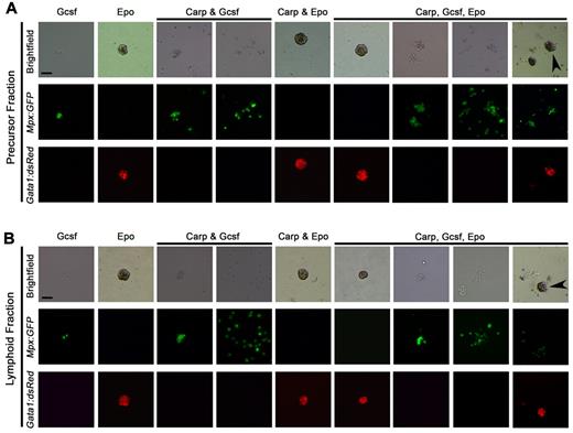 Figure 3. G-csf encourages myeloid differentiation, whereas Epo encourages erythroid differentiation from zebrafish hematopoietic progenitors. (A) Brightfield images (top row), mpx:eGFP fluorescence (middle row), and gata1:DsRed fluorescence (bottom row) of colonies grown in various growth factor conditions from the precursor fraction of WKM (conditions listed along top row of images). (B) Brightfield images (top row), mpx:eGFP fluorescence (middle row), and gata1:DsRed fluorescence (bottom row) of colonies grown in various growth factor conditions from the lymphoid fraction of WKM (conditions listed along top row of images). All images photographed at magnification 50×. Scale bars in top left panels are 50 μm. Arrowheads in top right panels denote mixed (CFU-granulocyte, erythroid, macrophage colonies) colonies.