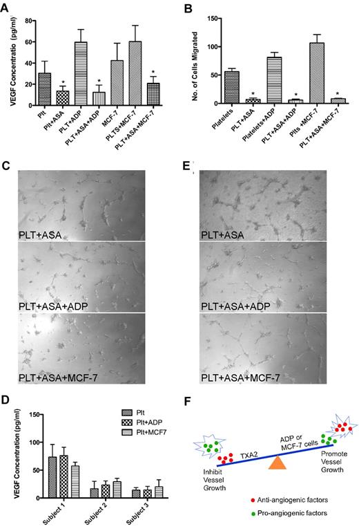 Figure 7. Aspirin inhibits VEGF release and angiogenesis mediated by ADP or MCF-7 cell exposure. (A) VEGF concentration in the releasate of platelets (plts) with or without pretreatment with aspirin (asa) alone or with exposure to ADP (25μM) or MCF-7 cells. (B) Endothelial cell migration after exposure to the releasate from platelets pretreated with aspirin alone or before exposure to ADP or MCF-7 cells. (C) Capillary tube formation using releasate from platelets pretreated with aspirin alone or before exposure to ADP or MCF-7 cells. (D) VEGF concentration in the releasate of platelets from subjects who ingested aspirin alone or after exposure to ADP or MCF-7 cells. (E) Representative images of capillary tube formation using platelet releasate from subjects who ingested aspirin with or without exposure to ADP or MCF-7 cells. (F) Schematic of the balance of pro- and anti-angiogenic factors and how this is influenced by platelet activation. Specific factors can influence which proteins are released from platelet α granules resulting in an overall pro- or anti-angiogenic effect. As diagrammed, TXA2 activation results in inhibition of blood vessel growth and ADP or MCF-7 cell regulated activation results in promotion of blood vessel growth.