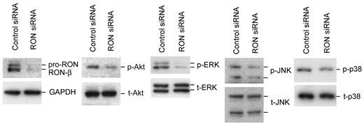 Figure 6. Knockdown of RON affects its downstream signaling pathways in LCLs. LCL-1 cells were electroporated with control siRNA or RON siRNA plasmids for 3 days. Cell lysates were harvested and the phosphorylation and total of Akt, JNK, ERK, and p38 were detected by Western blotting.