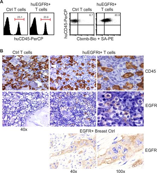 Figure 5. Use of EGFRt as a marker for in vivo detection of engineered cells. (A) Day 20 bone marrow cells harvested from mice that were engrafted with either unmodified huEGFRt-negative control T cells (Ctrl T cells) or huEGFRt-selected T cells (EGFRt+ T cells) were stained using peridinin chlorophyll protein-conjugated anti–human CD45 and biotinylated cetuximab followed by PE-conjugated streptavidin. Total percentage of CD45+ cells in bone marrow are indicated in the left-hand panels. Percentage of EGFRt+ cells within the CD45-gated population are indicated in the right-hand panels, using quadrants that were created based on isotype control staining. (B) Day 20 femurs were also analyzed by immunohistochemistry for CD45 versus EGFR expression. EGFR expression on paraffin-embedded breast tumor tissue was used as a positive control for EGFR staining. Representative ×40 and ×100 images are shown as indicated.