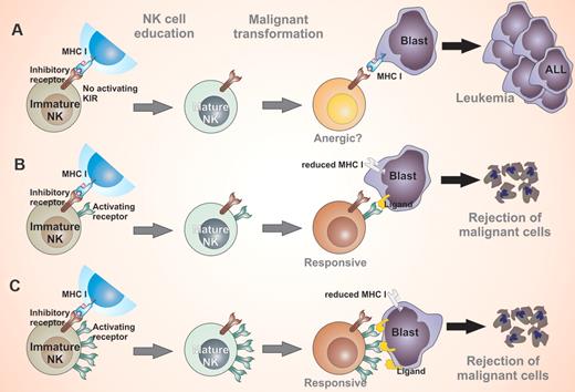 Childhood leukemia is thought to be associated with genetic factors, and investigators have focused on leukemia-promoting factors in the past. However, the development of leukemia could be a result of the inability of the immune system to attack and eliminate upcoming malignant cells (A). In the presence of KIR genes, the risk of childhood leukemia is reduced because of a possible attack of leukemia cells by NK cells or T cells (B). Inheriting a higher number of activating KIR genes (≥ 4) is associated with significant reductions in risk for ALL in children (C).
