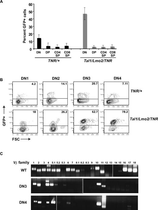 Figure 2. Notch1-active thymic progenitors are expanded in preleukemic Tal1/Lmo2 mice. (A) Six- to 8-week-old TNR/+ or Tal1/Lmo2/TNR mice were killed and thymocytes stained with CD4, CD8 antibodies. DP, SP, and DN populations were analyzed for percentage GFP+ cells by flow cytometry. (B) Lineage-negative cells were stained with CD25 and CD44 antibodies, and GFP+ was analyzed by flow cytometry. The percentage of GFP+ cells in the DN1, DN2, DN3, and DN4 progenitor populations is shown. (C) Using specific primers for Vβ1-18, TCR Vβ mRNA expression was examined in wild-type and sorted GFP+ DN3 and 4 thymic progenitors isolated from preleukemic Tal1/Lmo2 mice. Three mice were examined; one representative experiment is shown. Vertical lines have been inserted to indicate repositioned gel lanes.