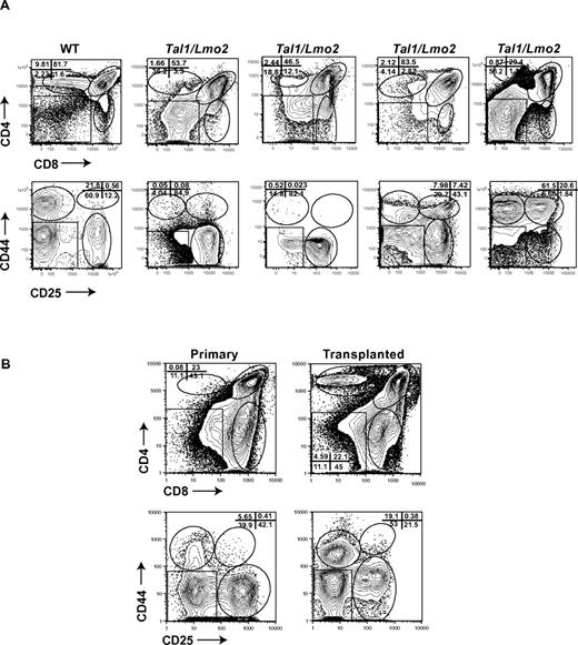 Figure 3. Immunophenotypic heterogeneity among mouse Tal1/Lmo2 tumors. (A) Wild-type thymocytes and 25 Tal1/Lmo2 tumors were stained with CD4 and CD8 antibodies, and the lineage-negative tumor cells were stained with CD25 and CD44 antibodies and analyzed by flow cytometry. Four representative Tal1/Lmo2 tumors are shown. Gating is based on the wild-type control stained with each individual tumor. (B) Tumor-associated thymic progenitors are maintained on transplant. Tal1/Lmo2 tumor cells were then injected via subcutaneous injection into recipient mice. At death, the immunophenotype of the transplanted tumor was reanalyzed by flow cytometry and compared with the primary tumor. Five tumors were analyzed; one representative tumor is shown.