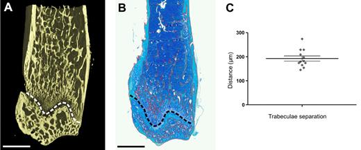Figure 3. HSPCs within the metaphysis exist in an endosteal niche. (A) Micro-CT image of the distal region of a murine femur, revealing the dense interconnecting network of trabeculae. (B) Montage of a toluidine blue-stained paraffin wax section of the distal metaphysis of the exact same murine femur as in the adjacent micro-CT image after histologic processing. The trabeculae are delineated in red using Metamorph software and appear more sparsely distributed than in the more detailed 3D micro-CT image. (A-B) The growth plate is delineated by the dashed line. Above the growth plate is the metaphysis, and below the growth plate is the epiphysis. Scale bar represents 1 mm. (C) Analysis of micro-CT 3D images reveals the distance separating trabeculae. The 12 data points represent individual measurements from the proximal and distal metaphysis from 6 mice. Data are mean ± SEM.