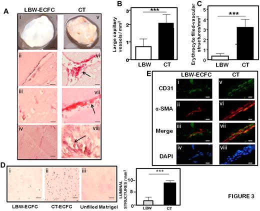 Figure 3. Formation of vascular networks in vivo with from LBW or CT-ECFCs neonates. A mixture of ECFCs and SMC (ratio 75:25) was resuspended in growth factor-reduced Matrigel and implanted on the groin area of 5-week nu/nu mice. Implants were harvested after 7 days and stained with hematoxylin and eosin or labeled by fluorescent staining as described in “Methods.” (A) Representative serial sections of Matrigel plugs filled with LBW-ECFCs (left panel) or CT-ECFCs (right panel): (i,v) Matrigel plugs recovered from nu/ν mice. H&E staining showing vessel-like structures in plugs filled with: (ii-iv) LBW-ECFCs and (vi-vii) NBW-ECFCs. Arrows indicate the presence of erythrocytes. (B) Quantification of large microvessel density per square millimiter. (C) Counts of erythrocyte-filled vessels per square millimiter. Results represent mean ± SEM from 9 fields in 2 separate sections. ***P < .001. (D) Representative photomicrographs of luminal microvessels in Matrigel plugs filled with: (i) LBW-ECFCs, (ii) CT-ECFCs, and (iii) unfilled Matrigel plug (left). Quantification of luminal structures per square millimiter. Results represent mean ± SEM from 9 fields in 3 separate sections. ***P < .005. (E) Immunofluorescent staining of: endothelial cells (i,v); with anti–human CD31 (green represents SMC) (ii,vi); with anti–human α-smooth muscle actin (red); merged image of CD31 and smooth muscle actin immunostaining (iii,vii); and 4,6-diamidino-2-phenylindole-stained nuclei (iv,viii; blue). Images were representative of implants into 2 mice (original magnification ×40). Scale bars represent 20 μm.