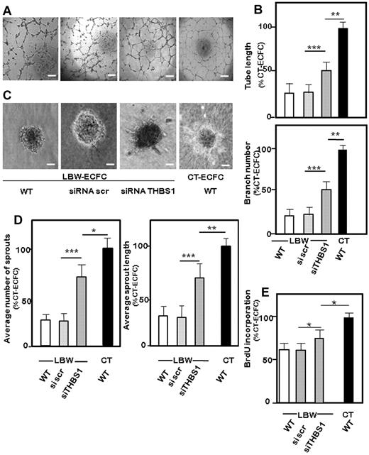 Figure 5. Involvement of THBS1 in the impaired angiogenic function of LBW-ECFCs. LBW-ECFCs (< 1500 g) were transiently transfected with scrambled siRNA or siRNA specific for THBS1, and cells were recovered 48 hours later for function testing. Representative experiments: (A) Capillary tube formation (original magnification 4×/0.13). Scale bars represent 200 μm. (C) Sprout formation from 3D spheroids (original magnification ×20). Scale bars represent 50 μm by LBW-ECFCs transfected with scrambled siRNA (scr), siRNA THBS1, or from wt-CT-ECFCs. (B) Quantification of tube length and branches by silenced ECFCs. (D) Total number of sprouts by spheroids (left panel) and total length of sprouts (right panel). (E) Proliferation of THBS1-silenced ECFCs: 48 hours after transfection, 10 000 LBW-ECFCs/well were plated, and BrdU incorporation was assayed. Data are mean ± SEM of 3 independent experiments performed in triplicate. *P < .05. **P < .01. ***P < .001.