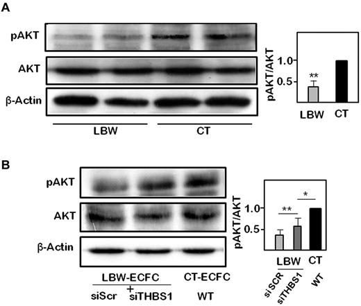 Figure 6. Modulation of AKT phosphorylation by thrombospondin 1 in LBW-ECFCs. pAKT and total AKT protein were determined by immunoblot as described in “Methods.” (A) Representative experiment of pAKT and total AKT protein expression in 2 independent < 1500-g LBW-ECFCs and > 2700-g CT-ECFCs. A total of 40 μg of cell lysate was loaded on a 12% acrylamide gel. After transfer, membranes were probed with anti-pAKT, stripped and blotted with antitotal AKT, stripped again, and probed with β-tubulin for charge control. (B) Representative immunoblots of pAKT and total AKT performed on cell lysates (40 μg) from LBW-ECFCs transfected with scr or THBS1 siRNAs. (Inset) Quantification of band intensity of 3 independent immunoblots. Data are mean ± SEM. *P < .05. **P < .01.