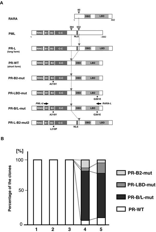 Figure 2. Clonal expansion of PML-B2 and RARA-LBD mutations during disease progression. (A) Schematic representation of PML, RARA, and its fusion proteins with or without mutations. Functional domains are indicated. Gray arrowheads indicate the break points of the fusion proteins. Black asterisks depict amino acid substitutions resulting from genetic mutations. Black arrows indicate the positions of the PCR primers for amplifying PML-RARA fusion transcripts. RING indicates the RING finger; B1 and B2, B-box motifs; C-C, coiled-coil; and DBD, DNA-binding domain. (B) Clonal expansion of PML-RARA mutants. Using the clinical samples obtained at time points 1-5 in Figure 1A, RT-PCR using PCR primers (PML-U and RARA-L in Figure 1A) followed by cloning was performed. At least 20 clones were sequenced for each sample. The percentages of the clones are depicted in the bar graph.