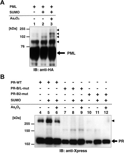 Figure 3. Posttranslational modification of PML, PR-WT, PR-B/L-mut, and PR-B2-mut induced by SUMO1/Ubc9. (A) HA-tagged PML and SUMO1/Ubc9 (SUMO) expression vectors were transfected into HeLa cells as indicated and incubated with or without As2O3 (10μM) for 8 hours. Immunoblot analysis using an anti-HA antibody was carried out. Black arrowheads indicate SUMO-modified PML. (B) Xpress-tagged PR-WT, PR-B/L-mut, or PR-B2-mut was overexpressed in HeLa cells with or without SUMO1/Ubc9 and incubated with or without As2O3 (10μM) for 8 hours. Black arrowhead indicates SUMO-modified/dimerized PR-WT (lanes 4-6). Note that the modified bands of PR-B/L-mut and PR-B2-mut were barely detected (lanes 7-12).