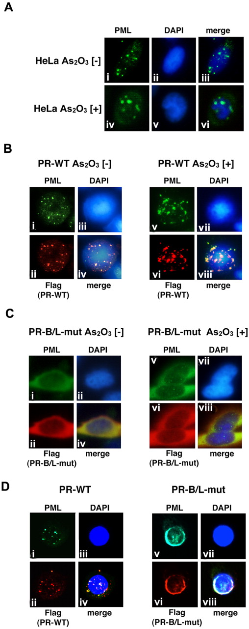 Figure 5. Analyses of the protein localization of PML, PR-WT, and PR-B/L-mut using IF staining. (A) HeLa cells were incubated with or without As2O3 (10μM) for 8 hours, and endogenous PML was detected with an anti-PML antibody. PML nuclear bodies were detected in green. The nuclei were stained with 4,6 diamidino-2-phenylindole (DAPI; blue). Note that the microgranular pattern of NBs without As2O3 (i and iii) was altered to become a macrogranular pattern with As2O3 (iv and vi). (B) Flag-tagged PR-WT was used for the same assay as described in panel A. Anti-FLAG and anti-PML antibodies were used to detect PR-WT and endogenous PML, respectively. PML bodies were confirmed in the cytoplasm with a microgranular pattern without As2O3 (i,ii, and iv) and a macrogranular pattern with As2O3 (v,vi, and viii). (C) When using Flag-tagged PR-B/L-mut, localization showed a diffuse pattern mostly in the cytoplasm with and without As2O3. (D) Flag-tagged PR-WT or PR-B/L-mut was overexpressed in U937 cells without As2O3, and the same IF staining was performed. Note that PR-B/L-mut localization was confirmed in the cytoplasm as a diffuse pattern. Magnification is 800×.