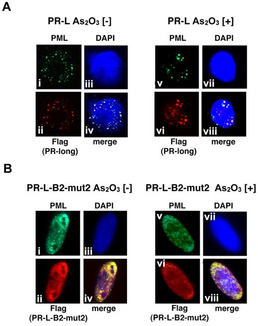 Figure 6. Analyses of the protein localization of PR-L and PR-L-B2-mut2 using IF staining. (A) Flag-tagged PR-L was overexpressed in HeLa cells with or without As2O3. Anti-FLAG and PML antibodies were used to detect PR-L and endogenous PML, respectively. PML bodies were confirmed in the nucleus with a microgranular pattern without As2O3 (i,ii, and iv) and a macrogranular pattern with As2O3 (v,vi, and viii). (B) A similar assay was performed using PR-L-B2-mut2. Note that the localization of PR-L-B2-mut2 was confirmed in the nucleus as a diffuse pattern with or without As2O3.